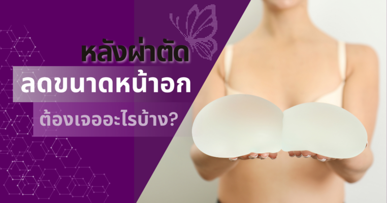 ลดขนาดหน้าอก