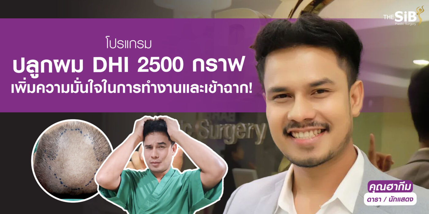 หัวล้าน อยากปลูกผม