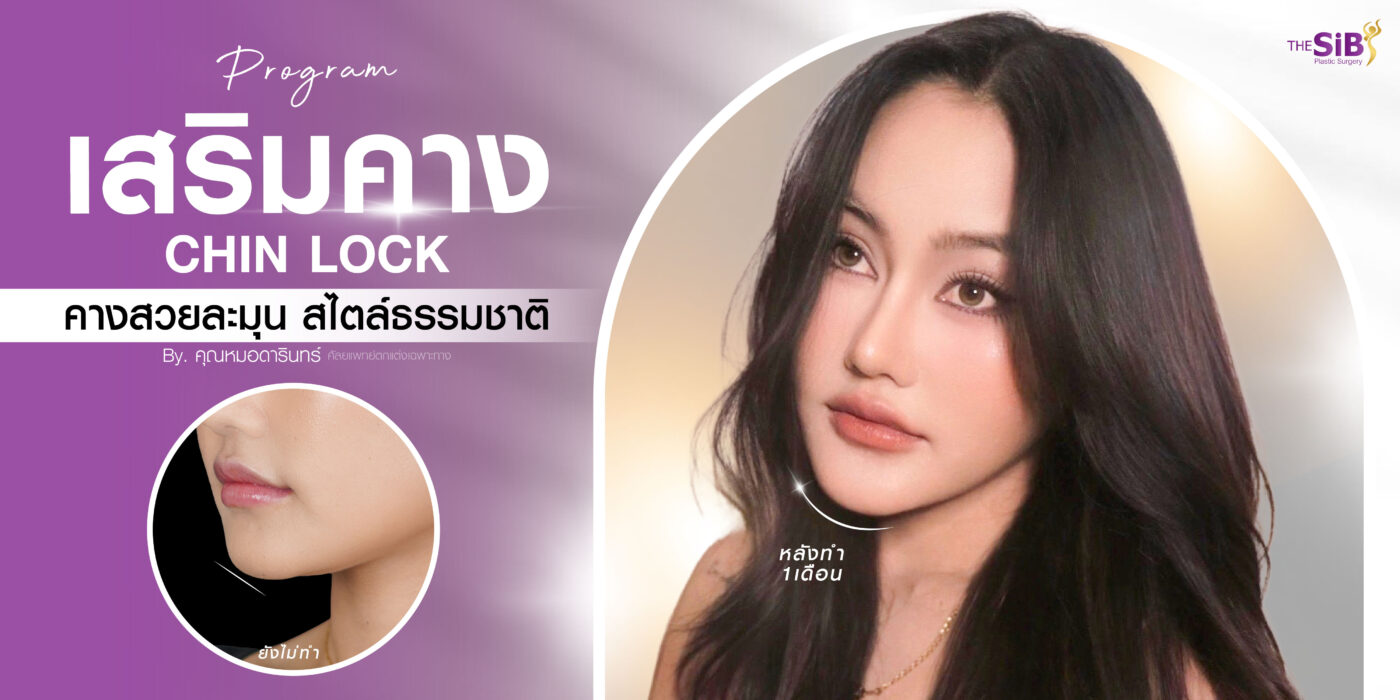 เสริมคาง 2 เดือน