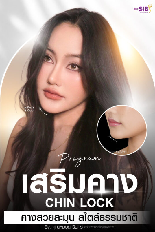 รีวิวทำคาง แก้ฟิลเลอร์