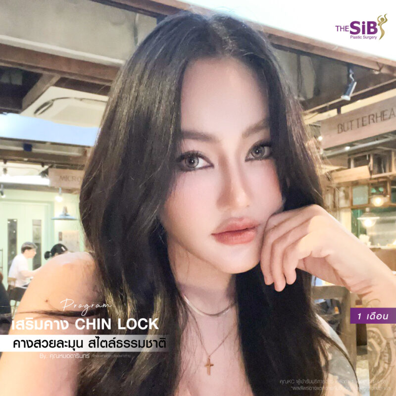 รีวิวทำคาง แก้ฟิลเลอร์