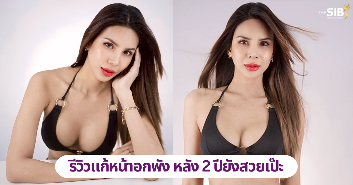 รีวิวแก้หน้าอก