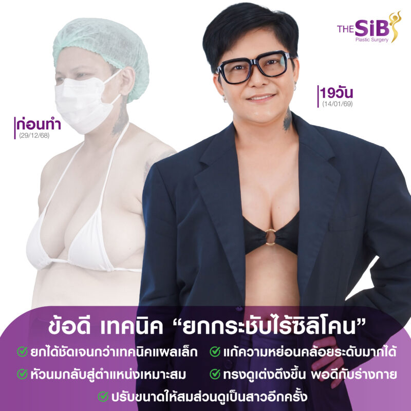 หน้าอกหย่อนคล้อย ยกกระชับหน้าอก