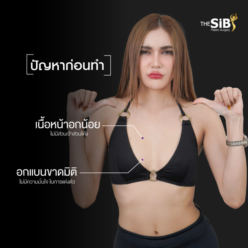 เสริมหน้าอกสาวตัวเล็ก
