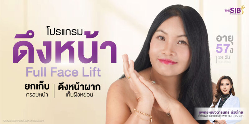 รีวิวดึงหน้า Full Facelift
