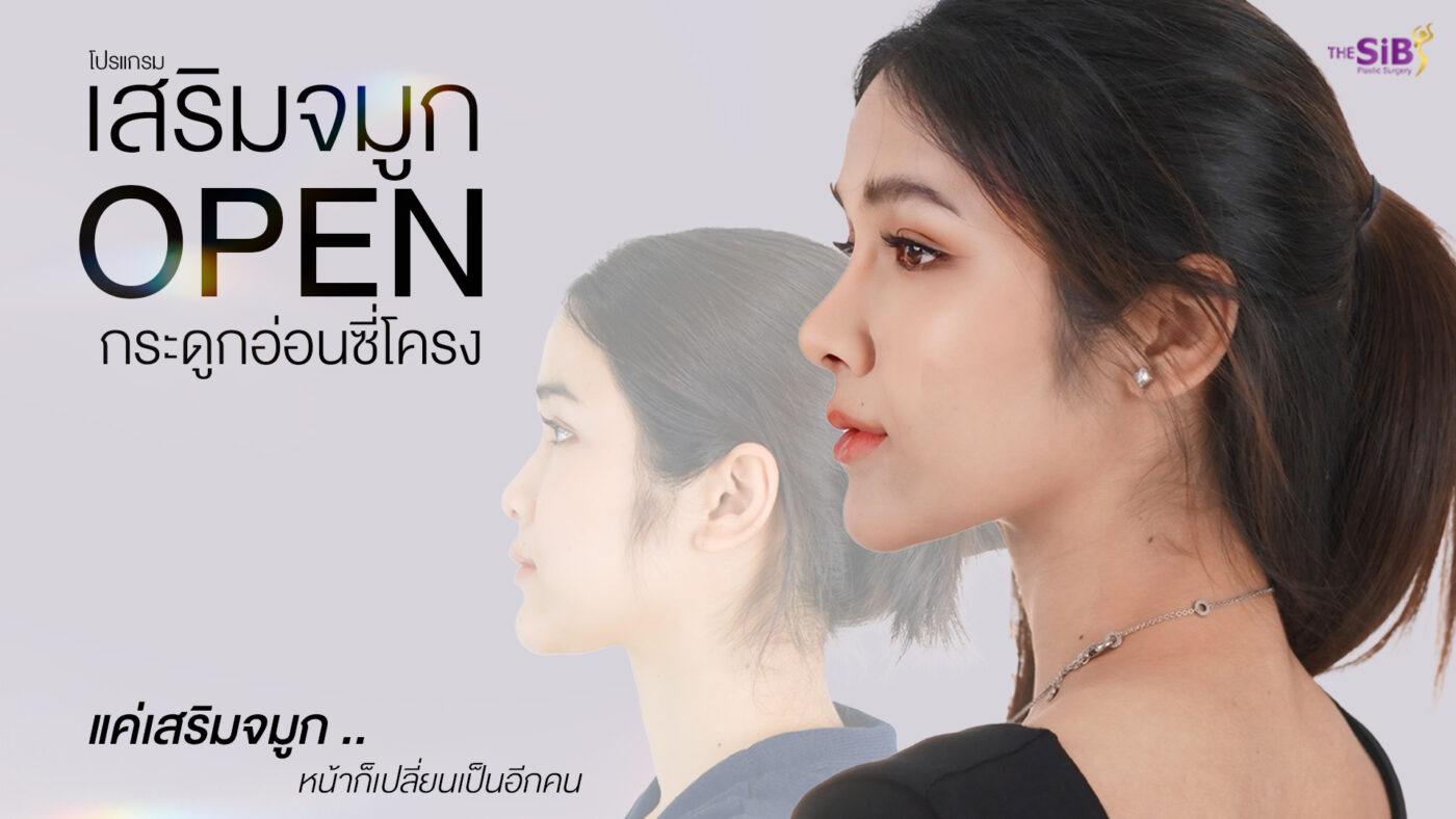 รีวิวเสริมจมูกโอเพ่น - คุณออม