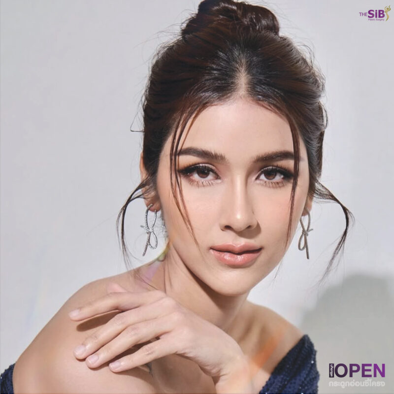 รีวิวเสริมจมูกโอเพ่น - คุณออม
