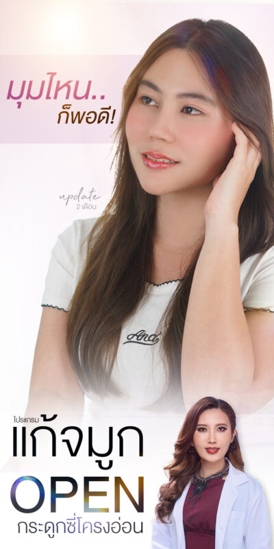 แก้จมูกซี่โครง