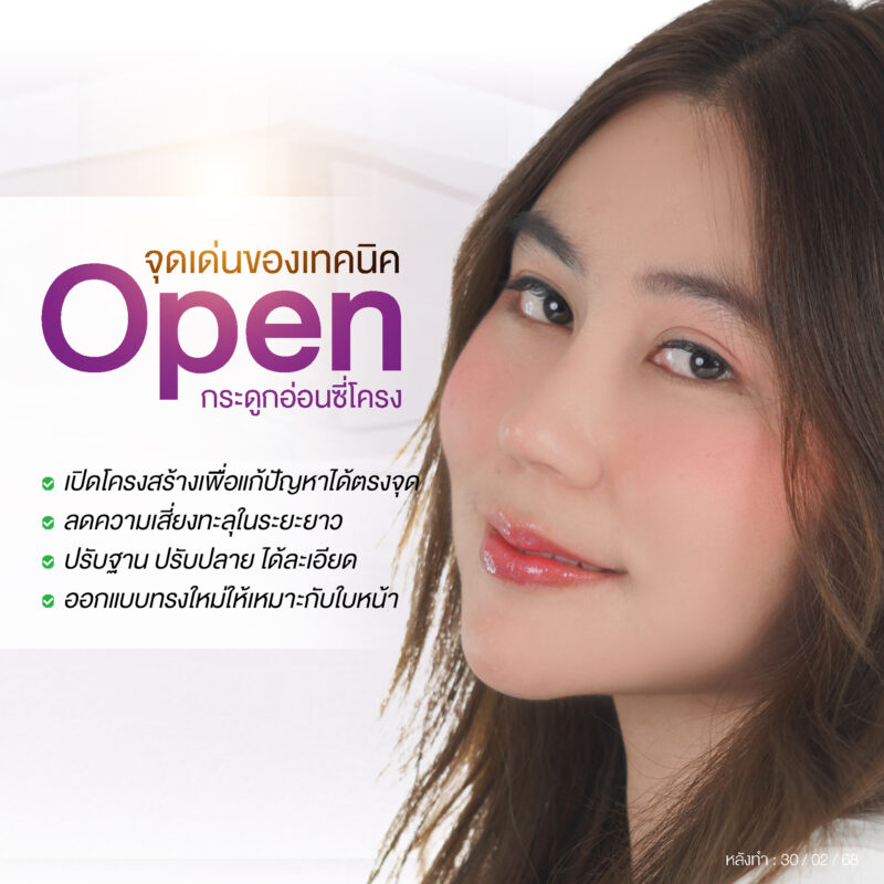 แก้จมูกซี่โครง