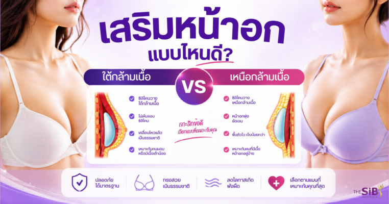 เสริมหน้าอกแบบไหนดี ใต้กล้ามเนื้อ เหนือกล้ามเนื้อ