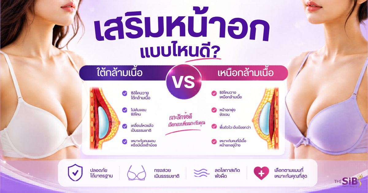เสริมหน้าอกแบบไหนดี ใต้กล้ามเนื้อ เหนือกล้ามเนื้อ