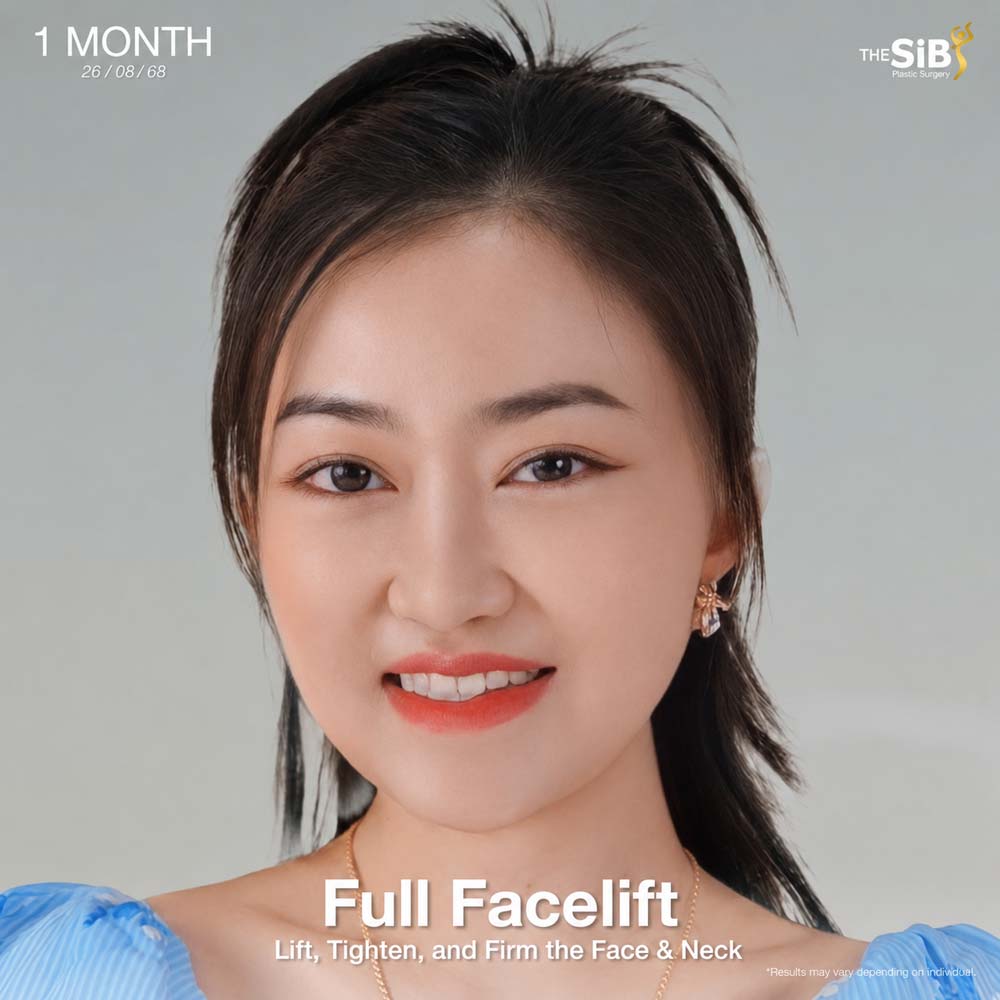 Overall before and after facelift revision review at The SiB Plastic Surgery