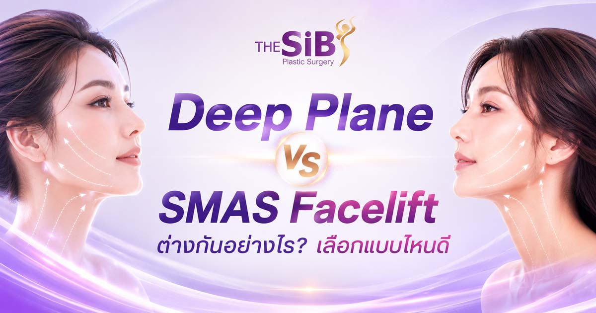 deep-plane-vs-smas-facelift