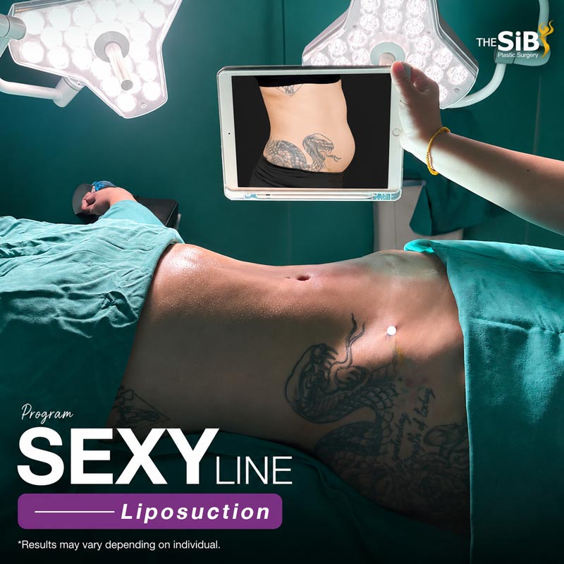 Atmosphere of the Sexy Line liposuction and 11-line abs creation at The SiB