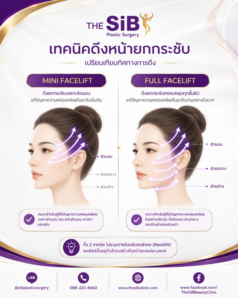 ภาพจำลองทิศทางการยกกระชับระหว่าง 2 เทคนิค Mini Facelift และ Full Facelift