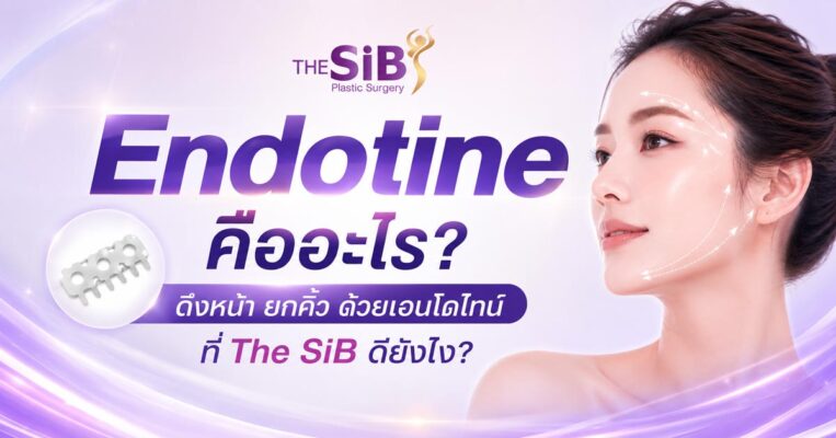 endotine-facelift