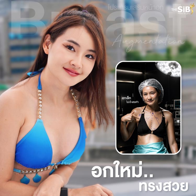 Pre-breast augmentation issues: small breasts and a pigeon chest