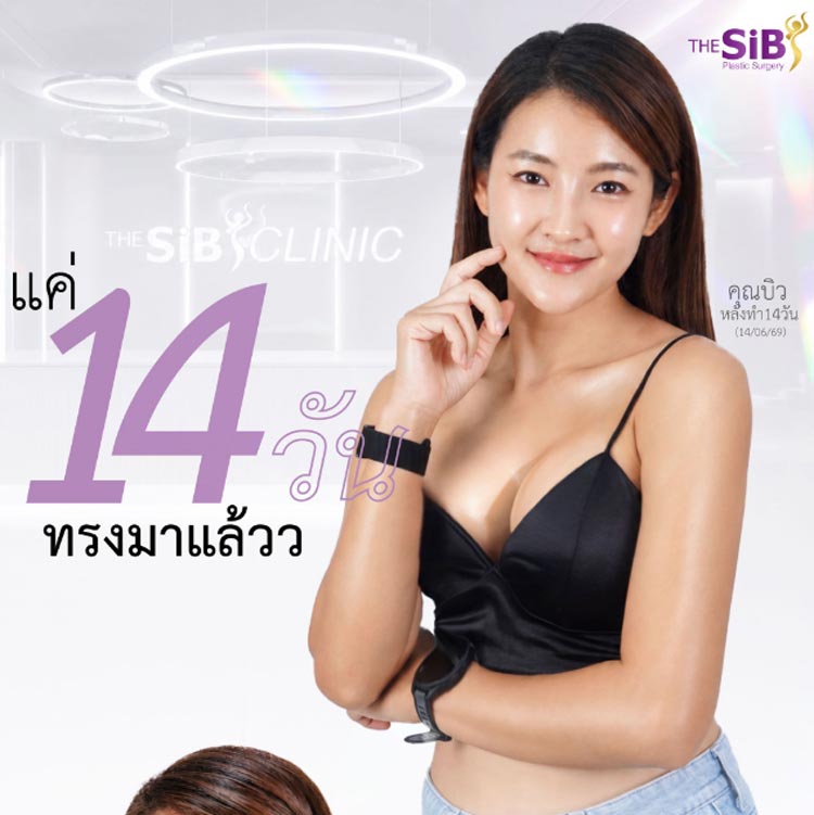 1-month breast augmentation update, more confidence in wearing fashion clothes