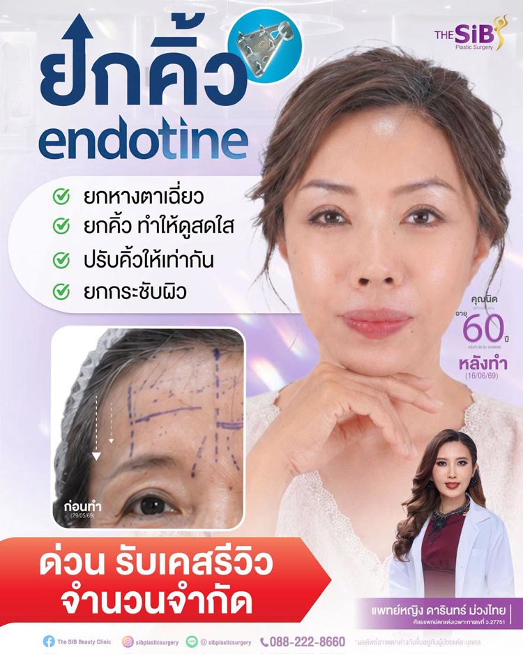 ความสง่างามและความมั่นใจหลังการยกคิ้ว