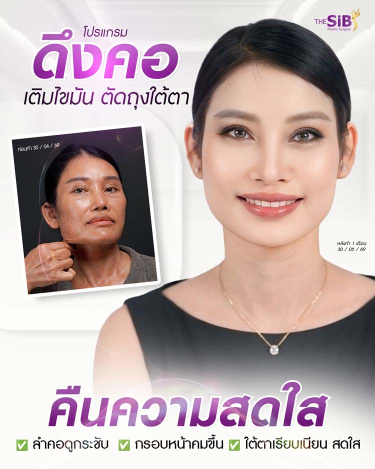 Summary of before and after neck lift results, restoring confidence at The SiB Plastic Surgery