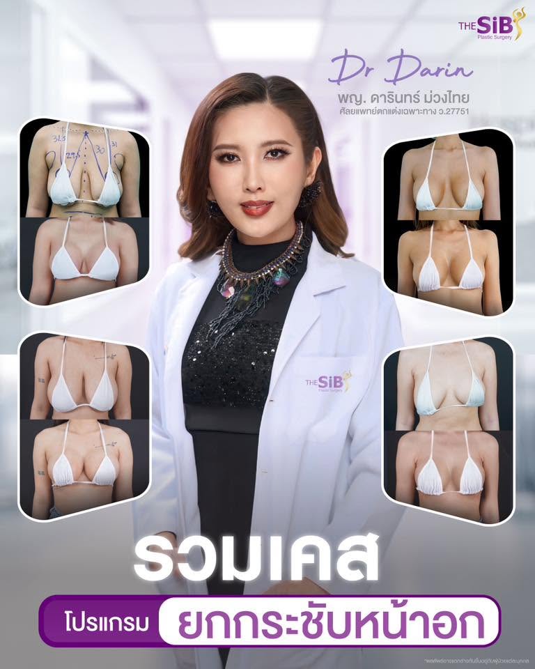 เสริมหน้าอก+ยกกระชับ