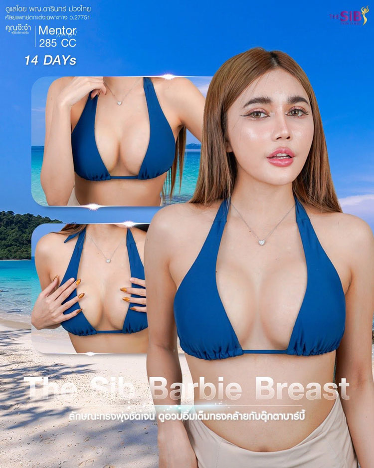 รีวิวเสริมหน้าอก Motiva