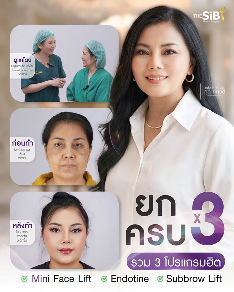 ผลลัพธ์ก่อนและหลังการยกคิ้วด้วย Endotine