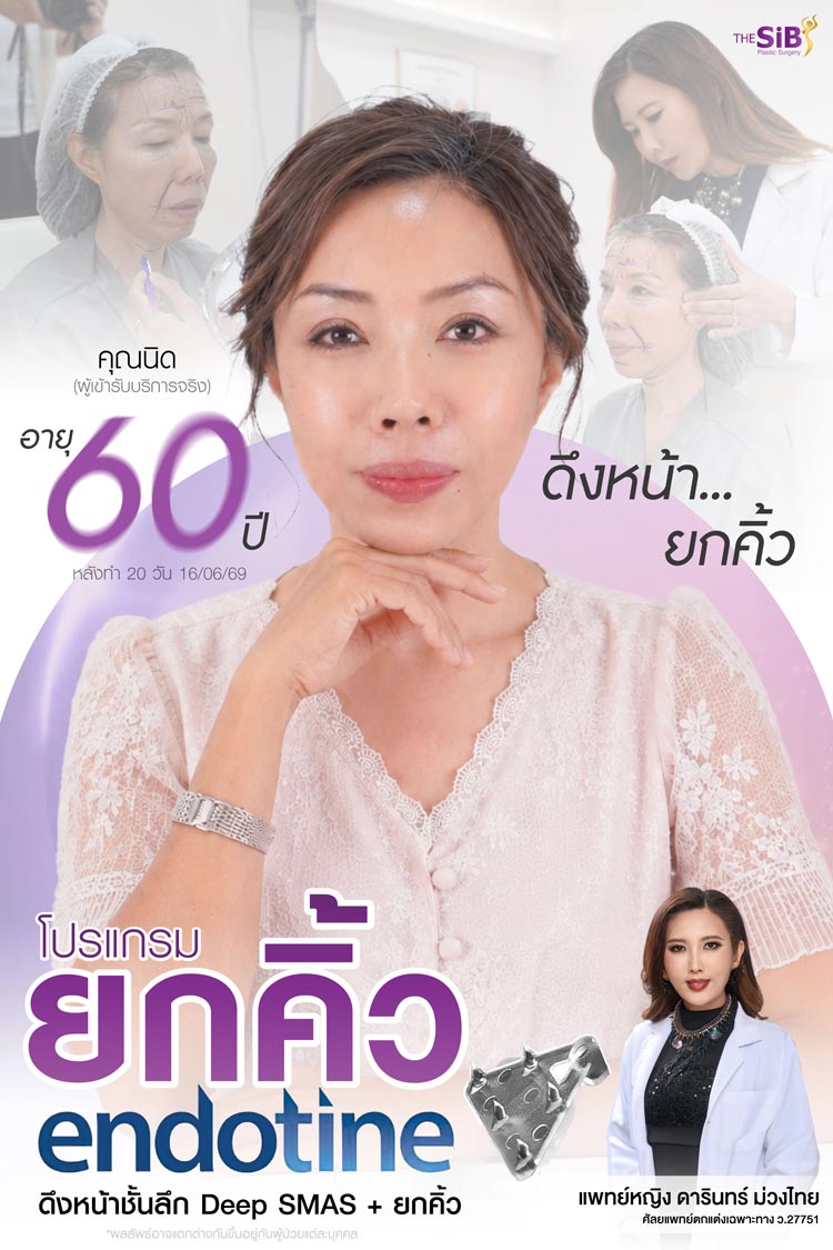 การดูแลหลังดึงหน้าอย่างใกล้ชิด โดยคุณหมอดารินทร์