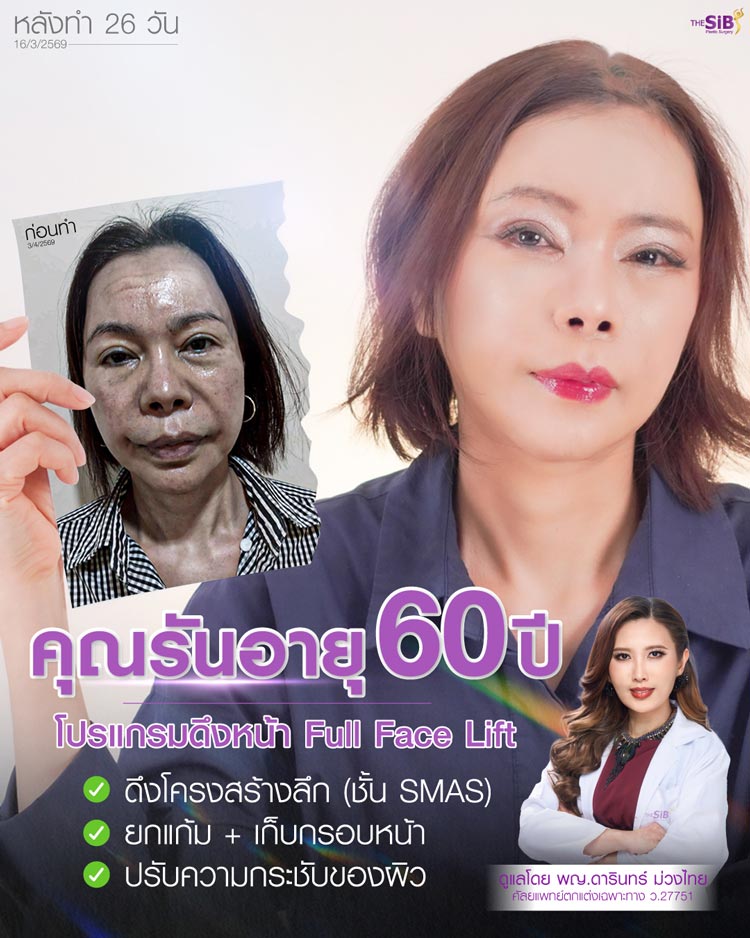 อัปเดตผลลัพธ์ดึงหน้า รอยแผลสวย ฟื้นตัวไว