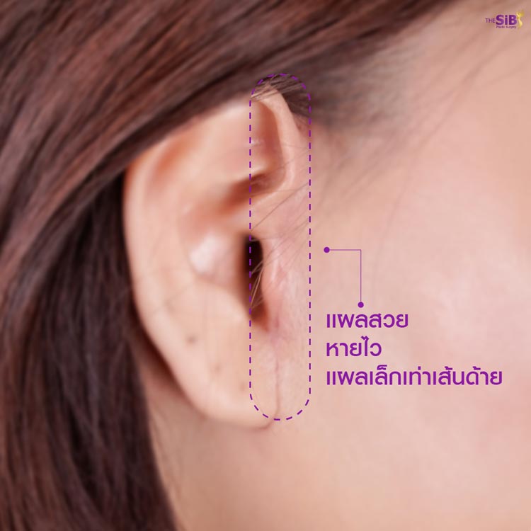 ปรึกษาคุณหมอดารินทร์ ประเมินโครงสร้างใบหน้า The SiB